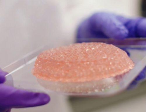 Healshape lève 6 millions d’euros pour développer sa prothèse mammaire bioimprimée en 3D