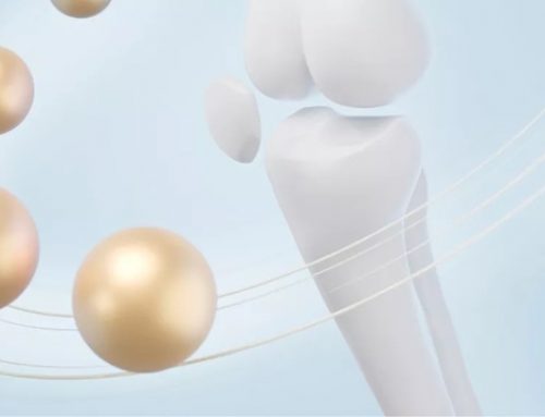 Arthrose du genou : 4Moving Biotech décroche 7,6 millions d’euros