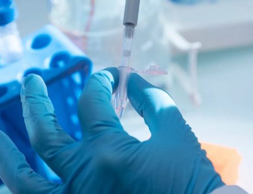 Sanofi et Immun4Cure s’unissent contre les maladies auto-immunes et inflammatoires