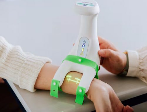 «Au départ nous allons produire des dizaines d’unités» : ses essais cliniques validés, la start-up caennaise Arterya passe à l’industrialisation de son appareil de localisation instantanée des artères