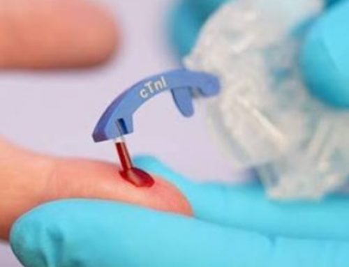 À Marcy-l’Étoile, bioMérieux lance un test capable d’aider à détecter un infarctus en 10 minutes